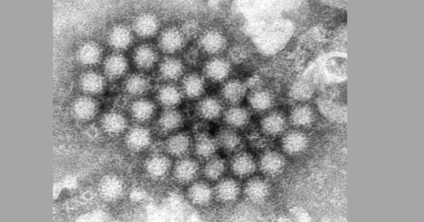 Alerta por Norovirus en Estados Unidos y Reino Unido: Medidas frente al aumento de casos